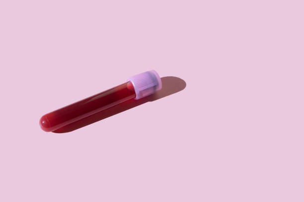 A Simple Blood Test Nearly Ended My Marriage Until the Past Caught Up With Us